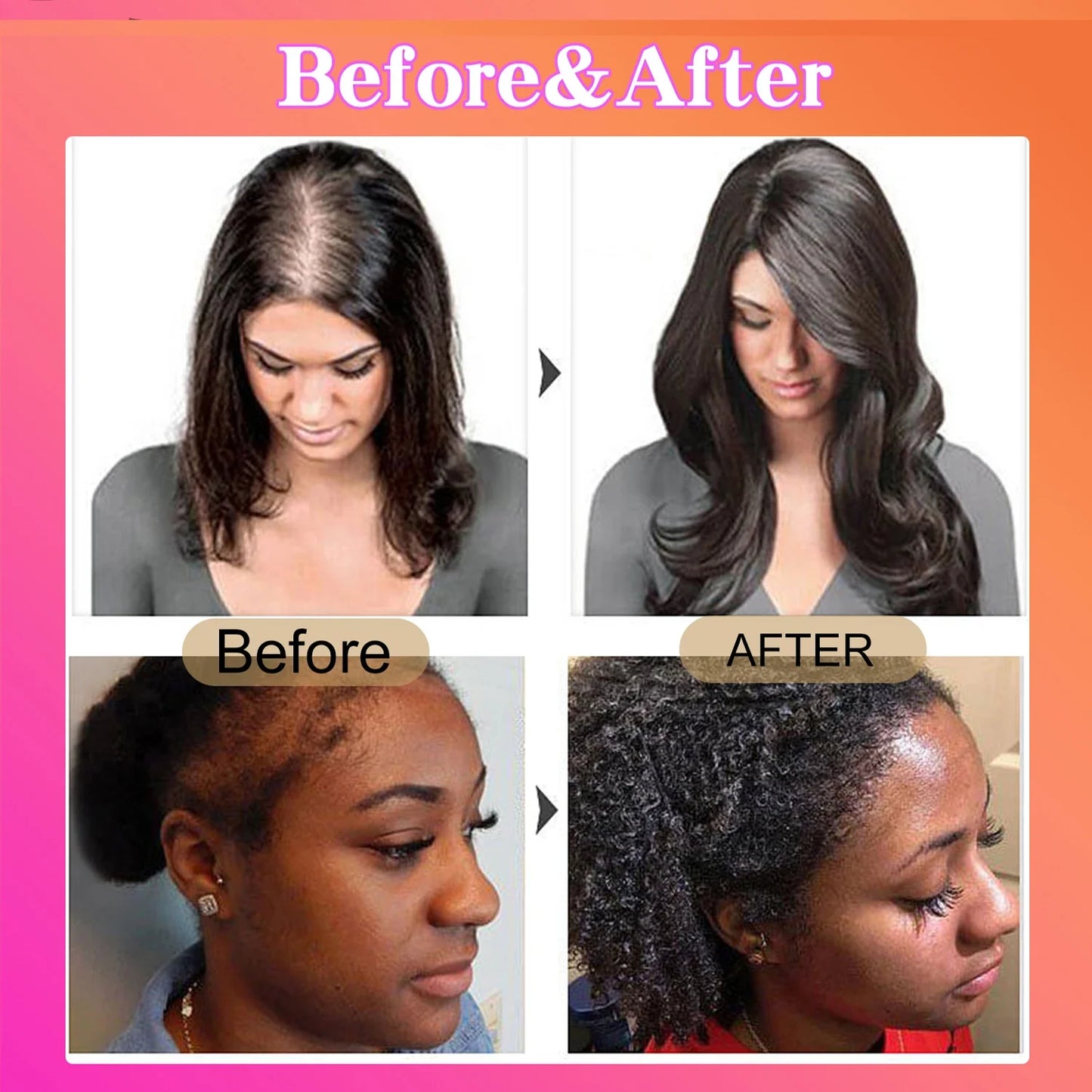 100% Unrefined Batana Oil – Revitalize Hair Growth & Strength | Botanix